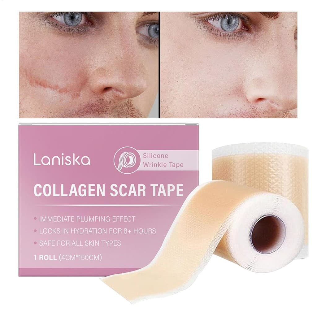 Fita De Remoção De Queloide De Cicatriz 1.6x59 Polegada Tiras De Silicone Folhas Para Cirurgia C-Seção Barriga Tuck Kelo
