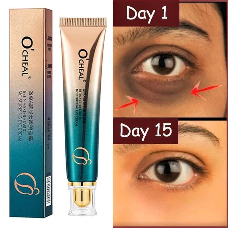 KIT Creme Anti-Rugas Para Os Olhos , Retinol Desbota Linhas Finas , Olheiras , Remove Bolsas