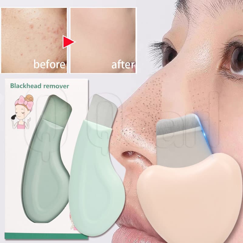 Espátula De Cravo Portátil-Mini Esfoliante Facial-Removedor De Beleza Nasal-Purificador Manual De Cuidados Com A Pele-Pá