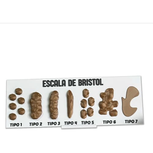 Escala De Bristol, Tabela Com Com Material Em Pla Resistente