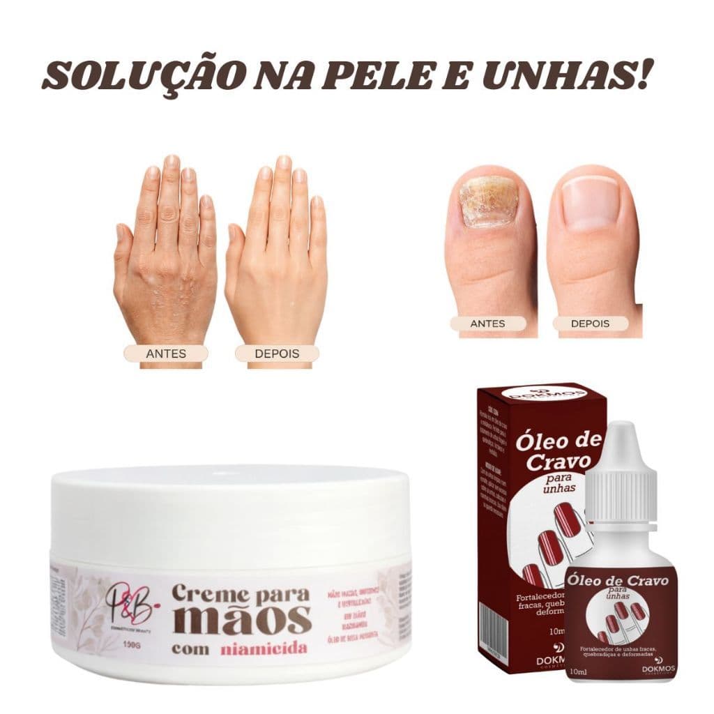 Kit Mãos E Unhas Creme Clareador Com Niacinamida Óleo De Cravo Fortalece Hidrata E Estimula Crescimento P&B Cosmeticos