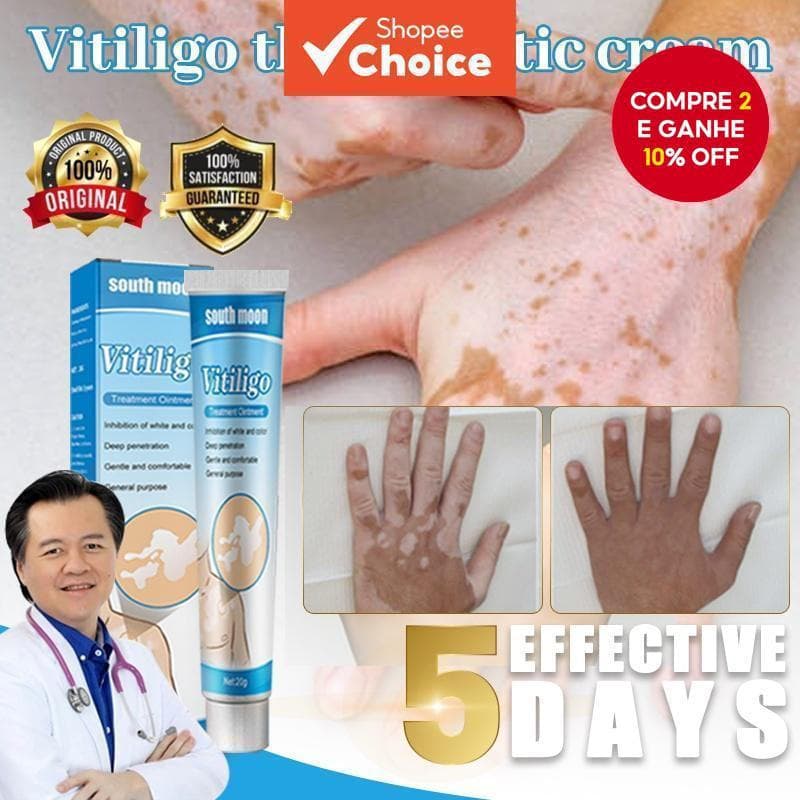 Pomada para Tratamento de Vitiligo e Manchas Brancas - Cuidado Localizado para Infecção Fúngica e Leucoplasmose, 20g de