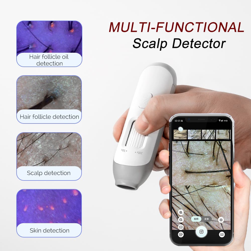 Foreverlily Multi-Função Detector De Folículo Capilar Do Couro Cabeludo HD USB Microscópio Analisador De Pele Plataforma