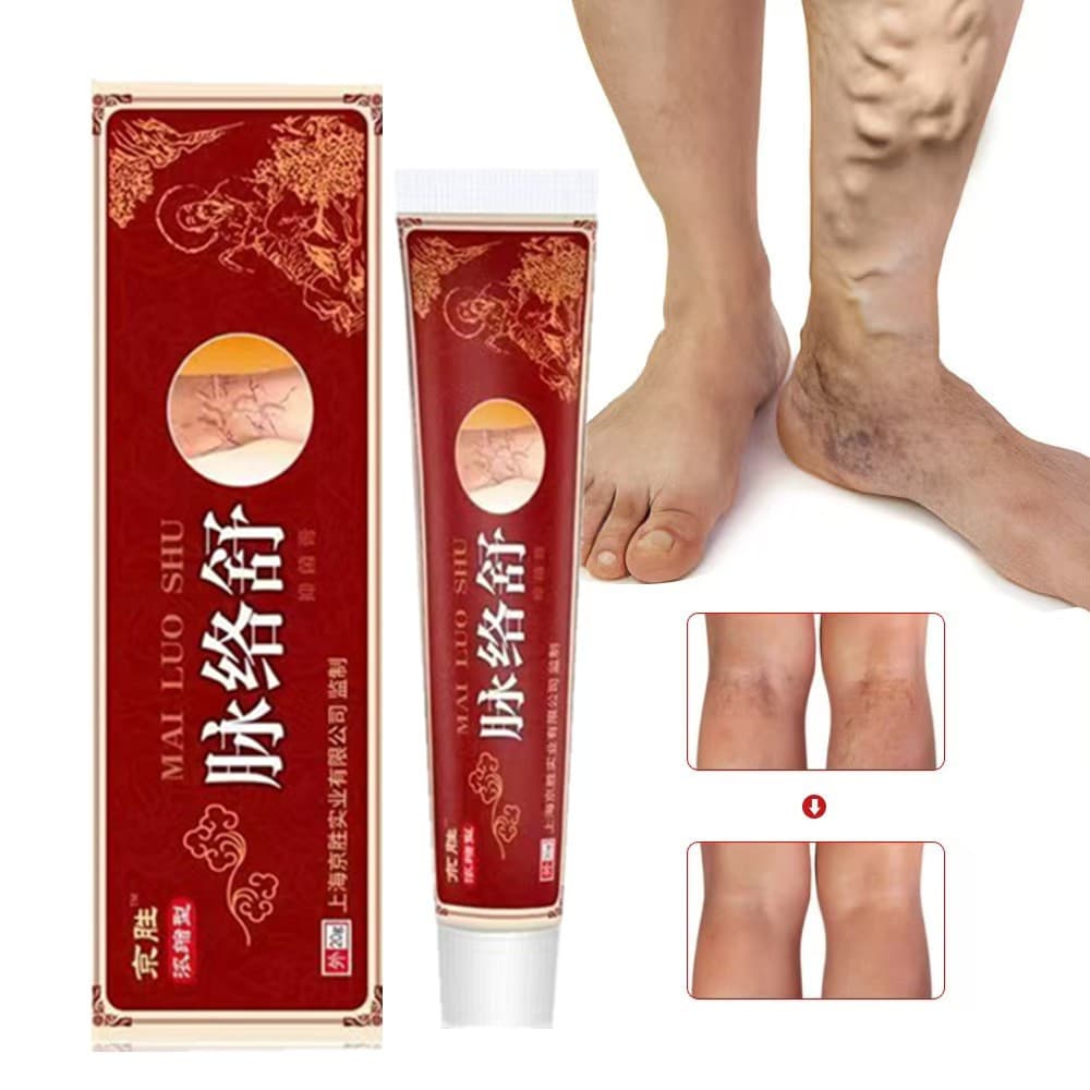Creme / Pomada Para Tratamento De Veias Varizes 1 Pçs 20g