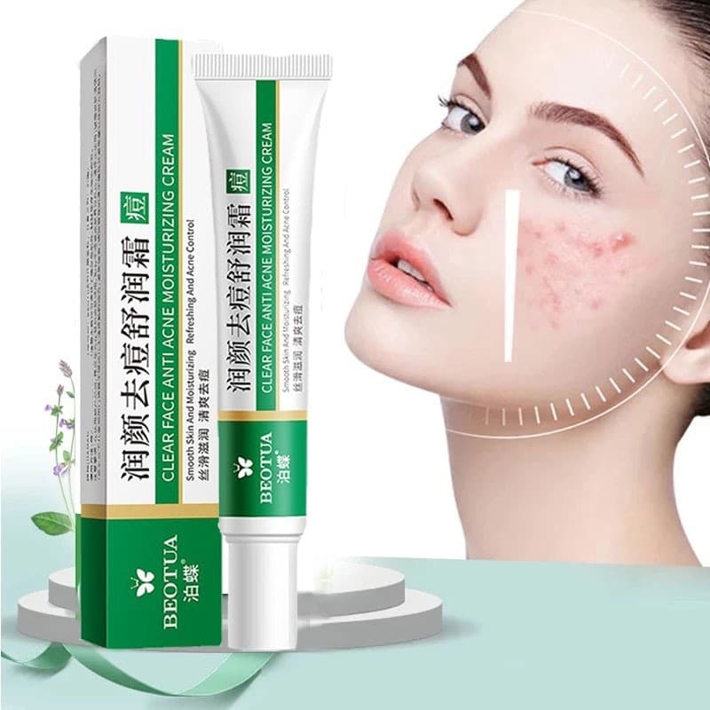 Creme Eficaz Para Remoção De Acne Pele Oleosa/Controle/20g Gel Cuidados Com A