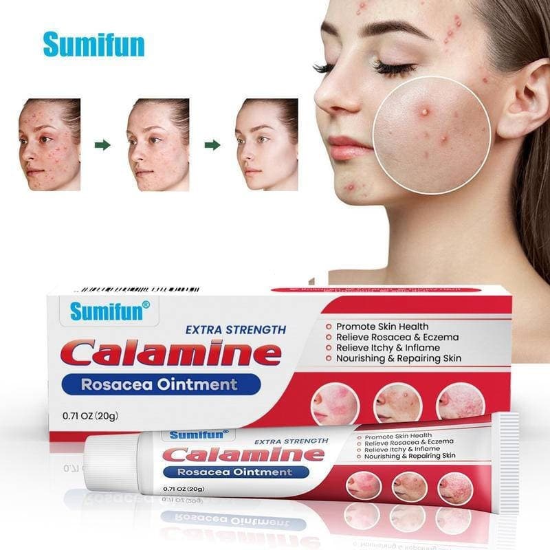 Pomada de Calamina 20g para Rosácea, Creme Calmante Extra Forte para Reparação de Acne, Tratamento de Pele 70EH WMRD