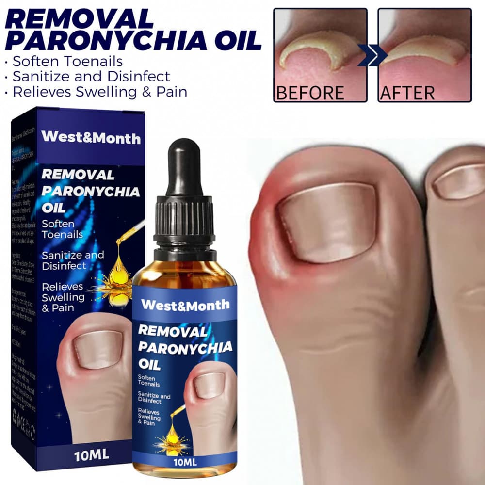 Cuidados Com As Unhas Anti Paroníquia Alívio Óleo Ajudante Ingrowth Correção De Líquido De Renovação Para De Desconforto