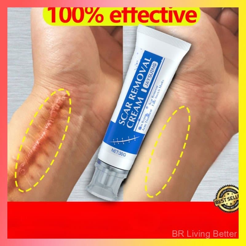 Gel Removedor de Cicatrizes para Cicatrizes Antigas nas Pernas, Marcas Originais, Creme para Acne, Remove Queimaduras No