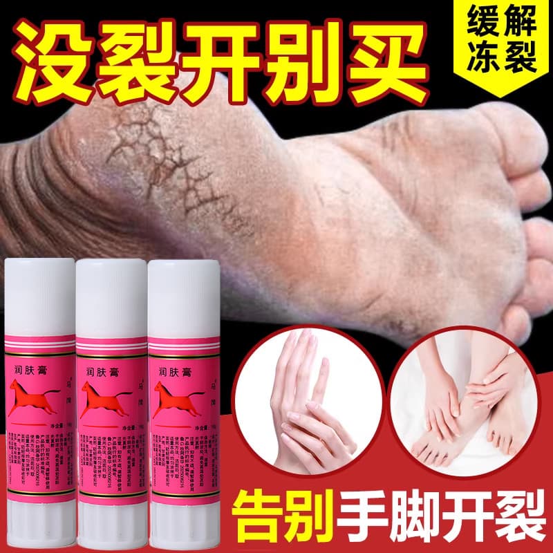 Qingdao Horse Brand Oil Stick Oil Óleo Hidratante Anti-Rachaduras Mão Pé Prevenção Anti-secagem Molhado Old-fashioned St