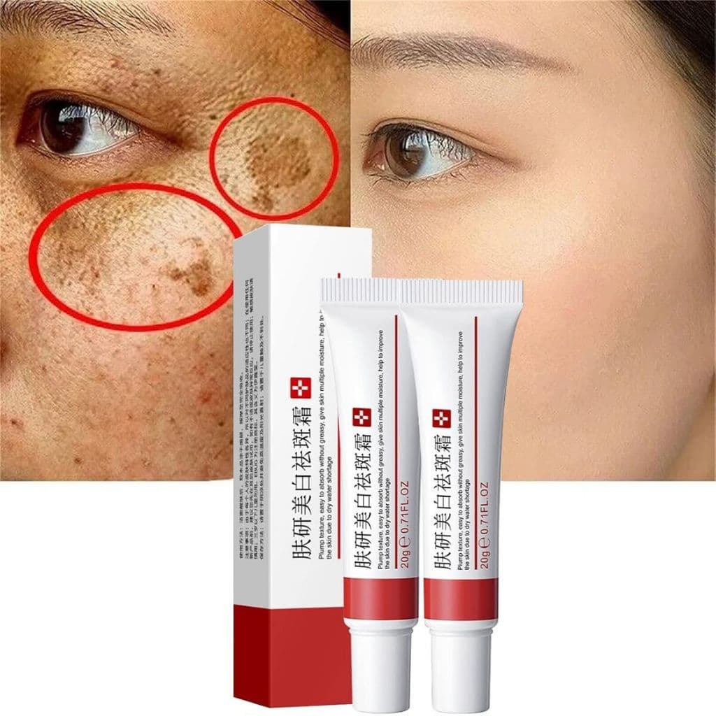 Creme Remoção De Sardas Ebug 20g-Adequado Para Todos Os Tipos De Pele