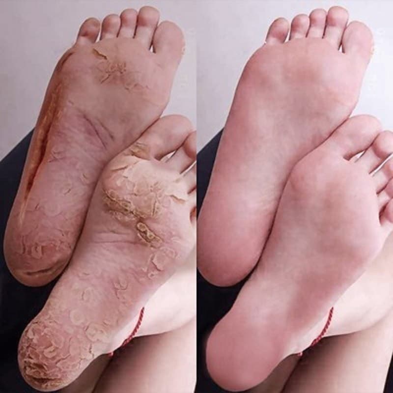 Recomendado Mãos secas pés recuperação rápida macio calcanhar suave hidratante creme para os pés