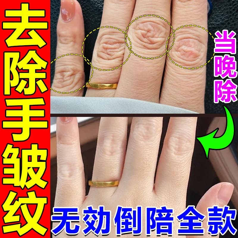 Remover rugas nas articulações dos dedos mão costas embotamento embotamento rugosidade reparação escuridão remover rugas