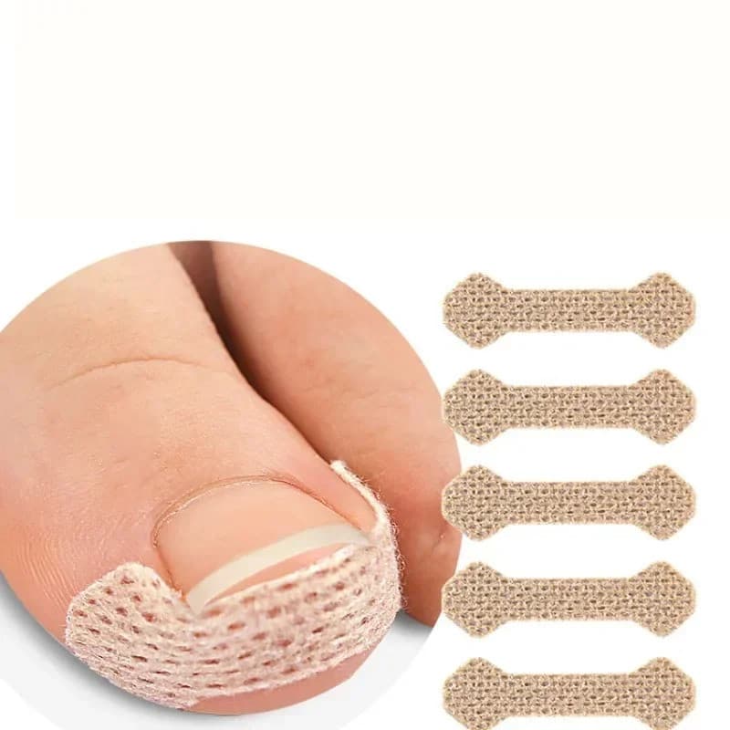 100 adesivos para correção de unhas encravadas, adesivos corretivos, corretores para recuperação e tratamento, ferrament