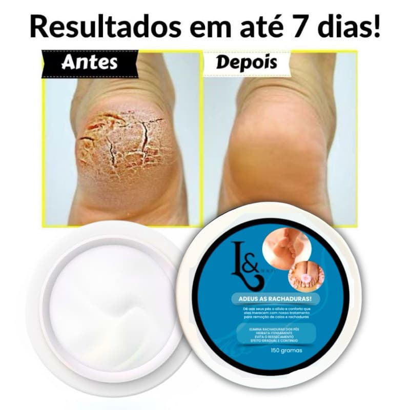 Creme Para Rachaduras Fissura Dos Pés Tratamento 150g - L&Beauty