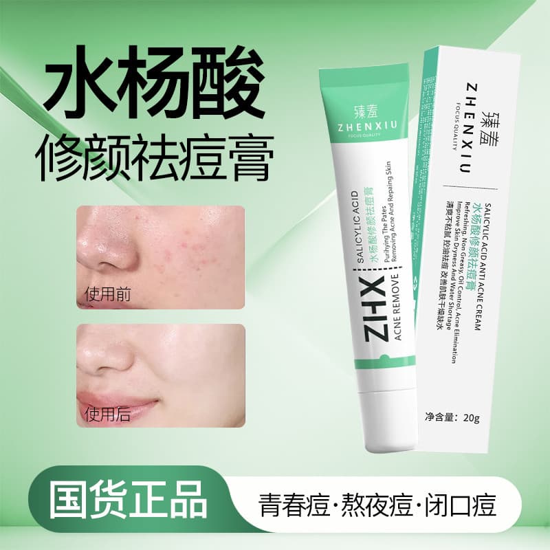 [Recomendado] Creme reparador de acne com ácido salicílico, reduz marcas de acne, Remove cravos, melhora os poros, hidra