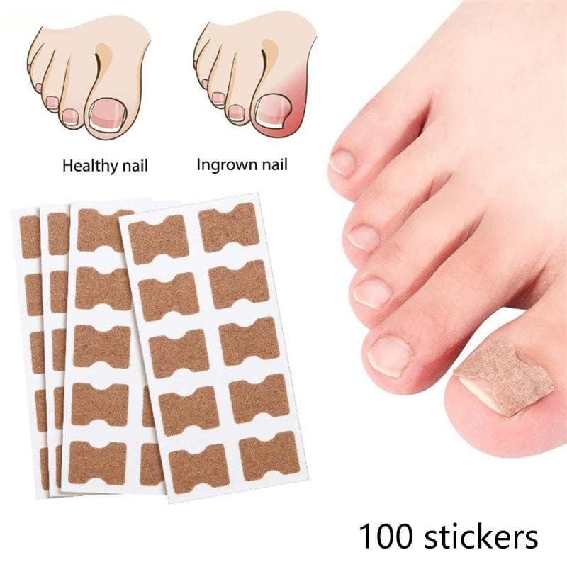 100 Unidades Unhas Adesivo Para Fungos Correção De Encravadas E Cuidados Com Paroníquia COD D3WQ