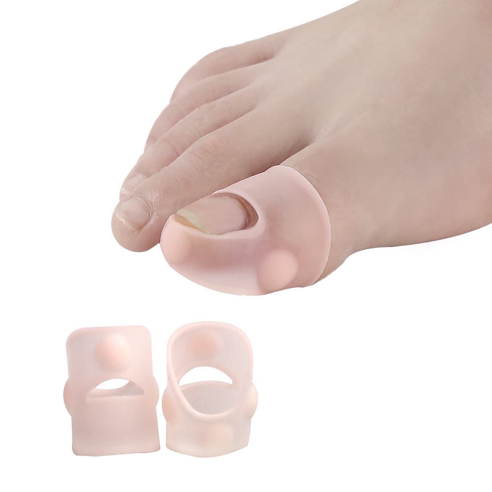Ferramentas de Manicure corretor de unhas encravadas alicate de correção de unhas removedor de unhas atacado correção an