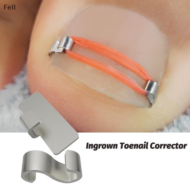 [Fel] Ferramentas Corretoras De Unhas Encravadas Pedicure Recuperar Incorporar Tratamento De Dedo Do Pé Profissional Cor