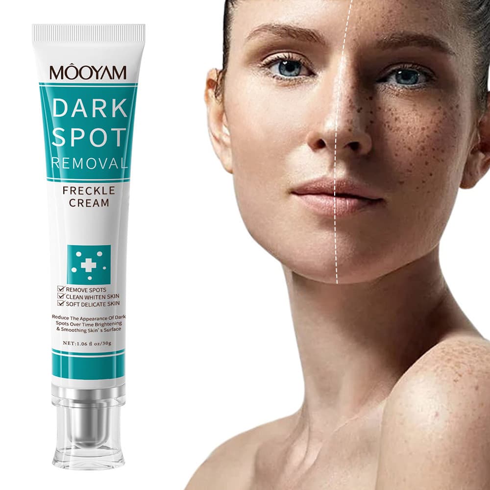Creme para manchas escuras Creme clareador para manchas