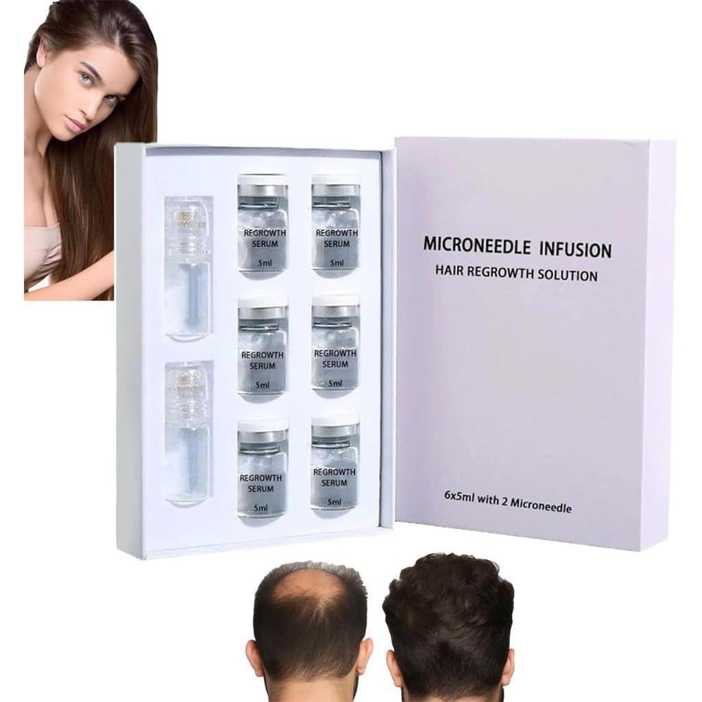Sistema de Regeneração Capilar AlphaInfuse - Solução de Regeneração Capilar por Microinfusão ALPHA INFUSE, Tecnologia de