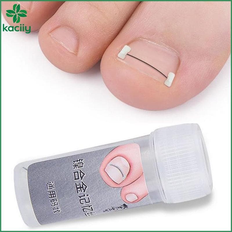 Ferramentas Corretoras De Unhas Encravadas , Pedicure , Recuperação , Tratamento Correção Profissional Cuidados Com Os P