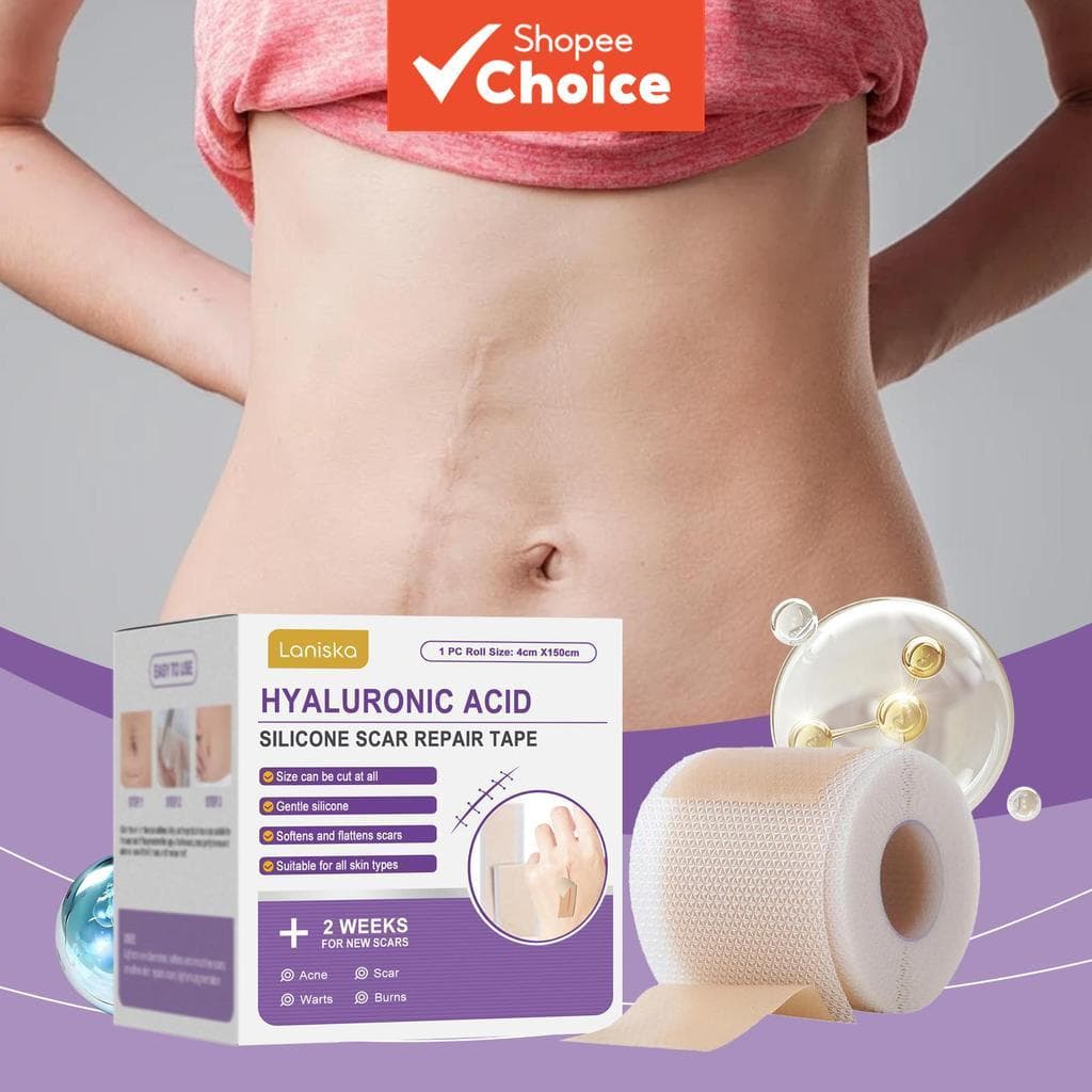 Fita De Reparo De Cicatriz De Silicone Com Ácido Hialurônico 4cm À Prova De 40cm-Rolo Cortável Suave Para Cicatrizes E Q