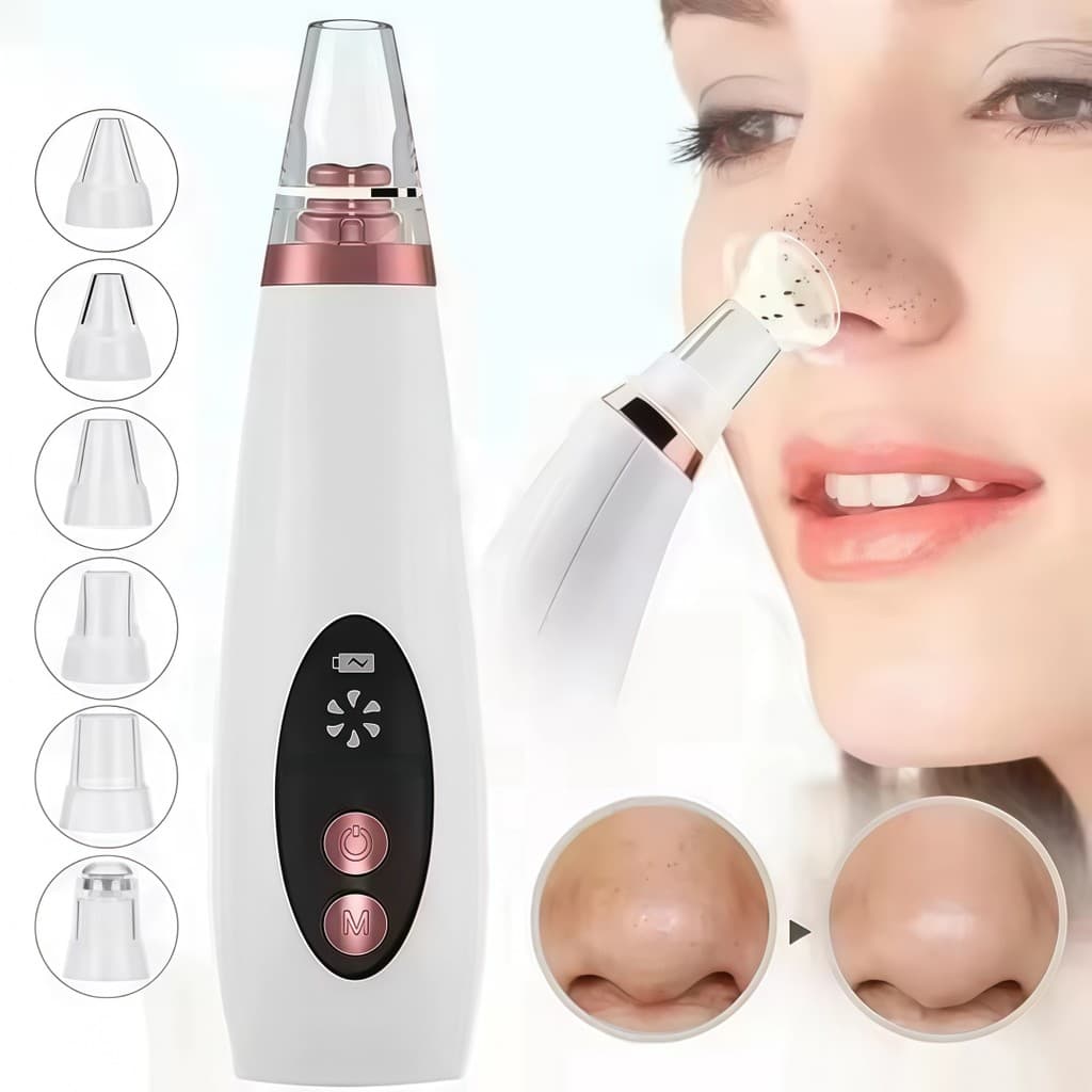 Removedor de Cravos Elétrico Portátil Limpeza Facial a Vácuo Com Ponteiras
