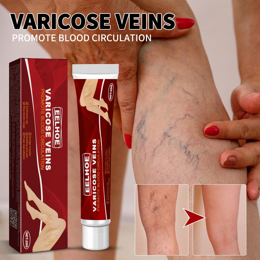 20g Creme Calmante Para Varizes | Extrato De Gerânio , Trevo E Erva Mãe Fortalece Os Olhos , Textura Leve