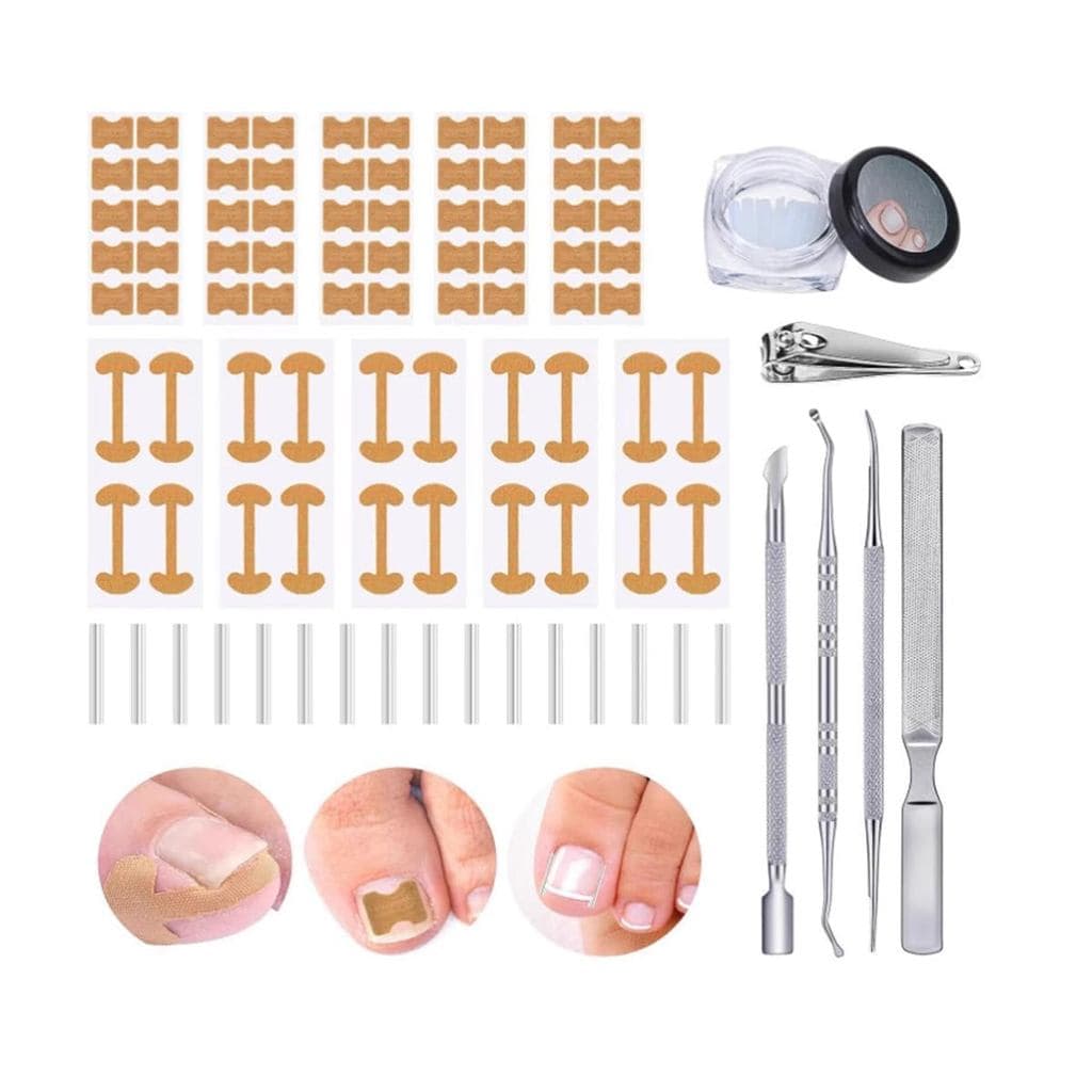 Conjunto Profissional para Unhas Encravadas com Tiras Respiráveis para Unhas Encravadas, Adesivo Corretor para Unhas Enc