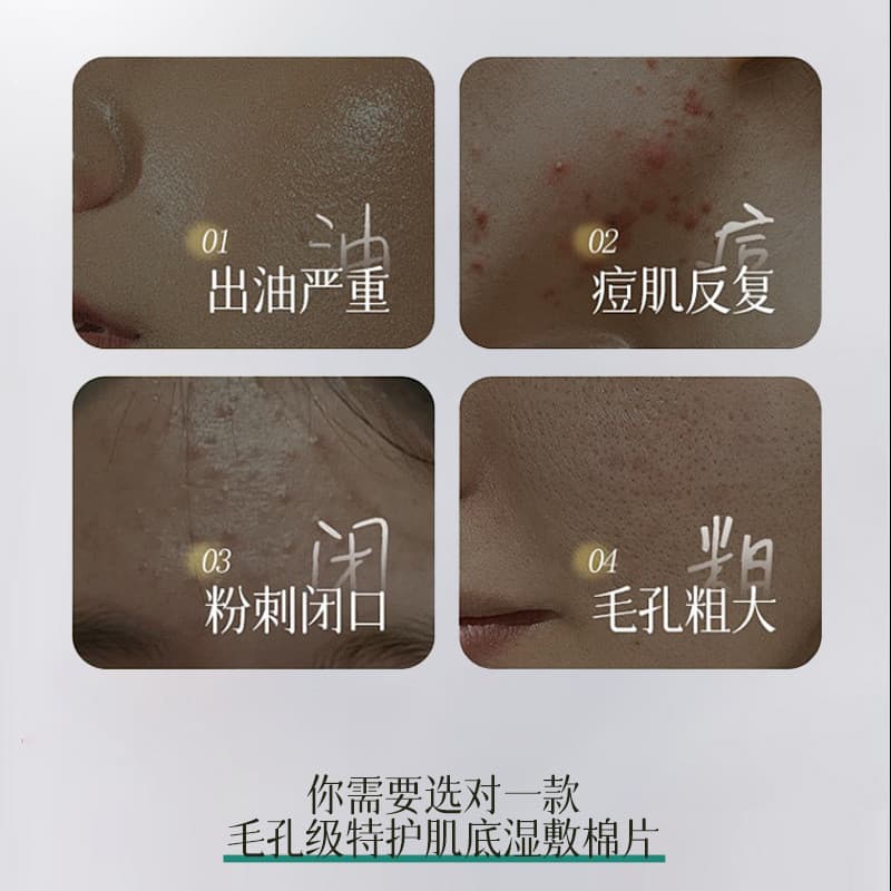 Lvfei lvfei almofadas de algodão para reparo de Acne, controle de óleo, hidratante, suave, delicado, essência de limpeza