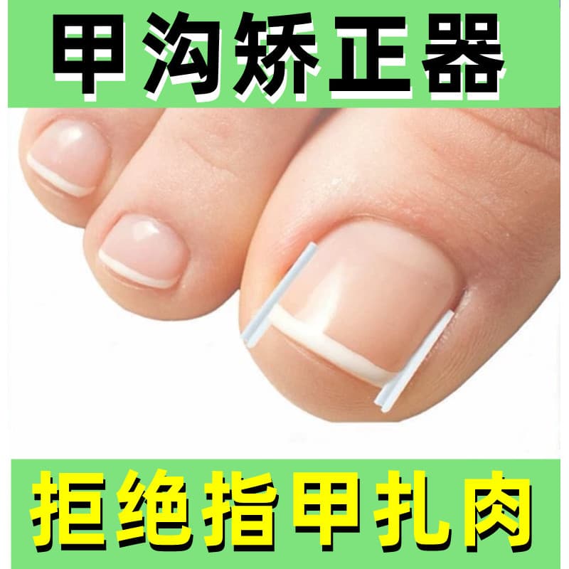 Prego sulco ferramenta útil corretor de unhas encravadas grandes unhas gravata longa inflamação da carne isolamento ench
