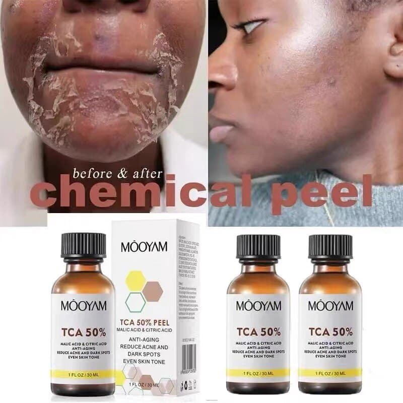 Tca 50 % Casca Química Peel Pele Ácida Superforce