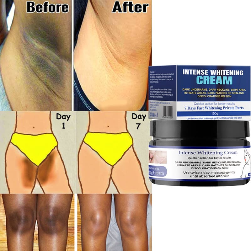 CREME BRANQUEADOR Cross-Border Neve CREME Privado Iluminando Rejuvenescedor Axilas Coxa Clareamento Interno CREME Preto