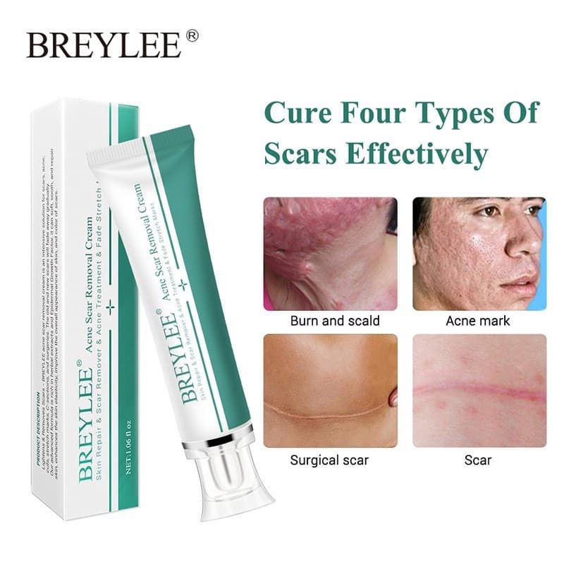 Creme para cicatrizes desbotadas, creme para cuidados com a pele, creme para cicatrizes em Gel de Silicone