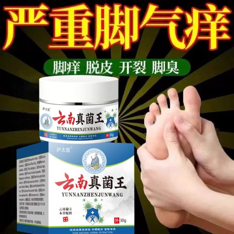 Miaojia Fungus King Creme para pés de atleta Anti-coceira Infecção por fungos Pequenas bolhas nos pés Dedos enevoados Pe