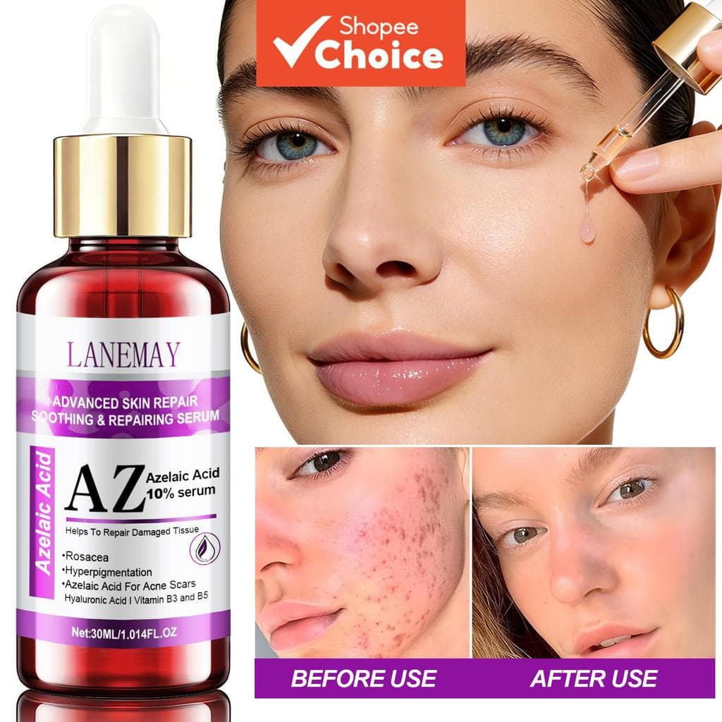 Sérum de Ácido Azelaico 10% - Reduz Rosácea, Hipercromia e Cicatrizes de Acne, com Ácido Hialurônico e Vitaminas B3+B5,