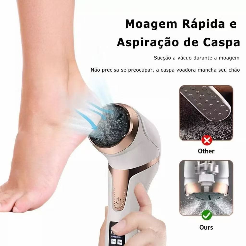 Lixa Elétrica Removedor Calo Esfoliador Pé Manicure Pedicure Tratamento Rachadura Hidratação Pés Profissional