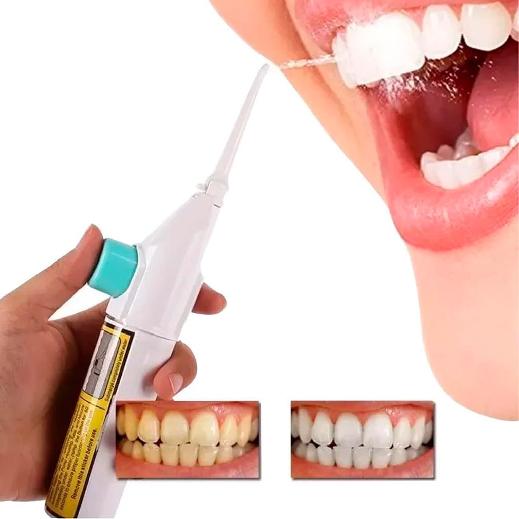 Irrigador Oral Portatil Jato De Agua Bucal Dentes Gengiva Power Floss Limpeza Ortodontica Anti Tartaro Higiene Boca