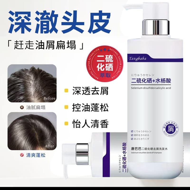 Selênio Disulfide Shampoo de Ácido Salicílico Anticaspa Controle de Óleo Shampoo Anti-Coceira Fofo Remover Ácaros Loja P