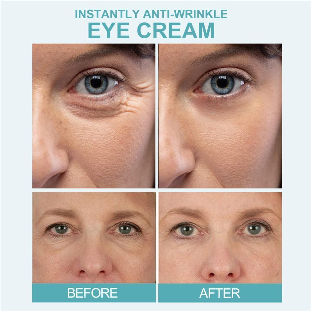 Creme Para Os Olhos Antirrugas , Melhorando As Olheiras E Remove