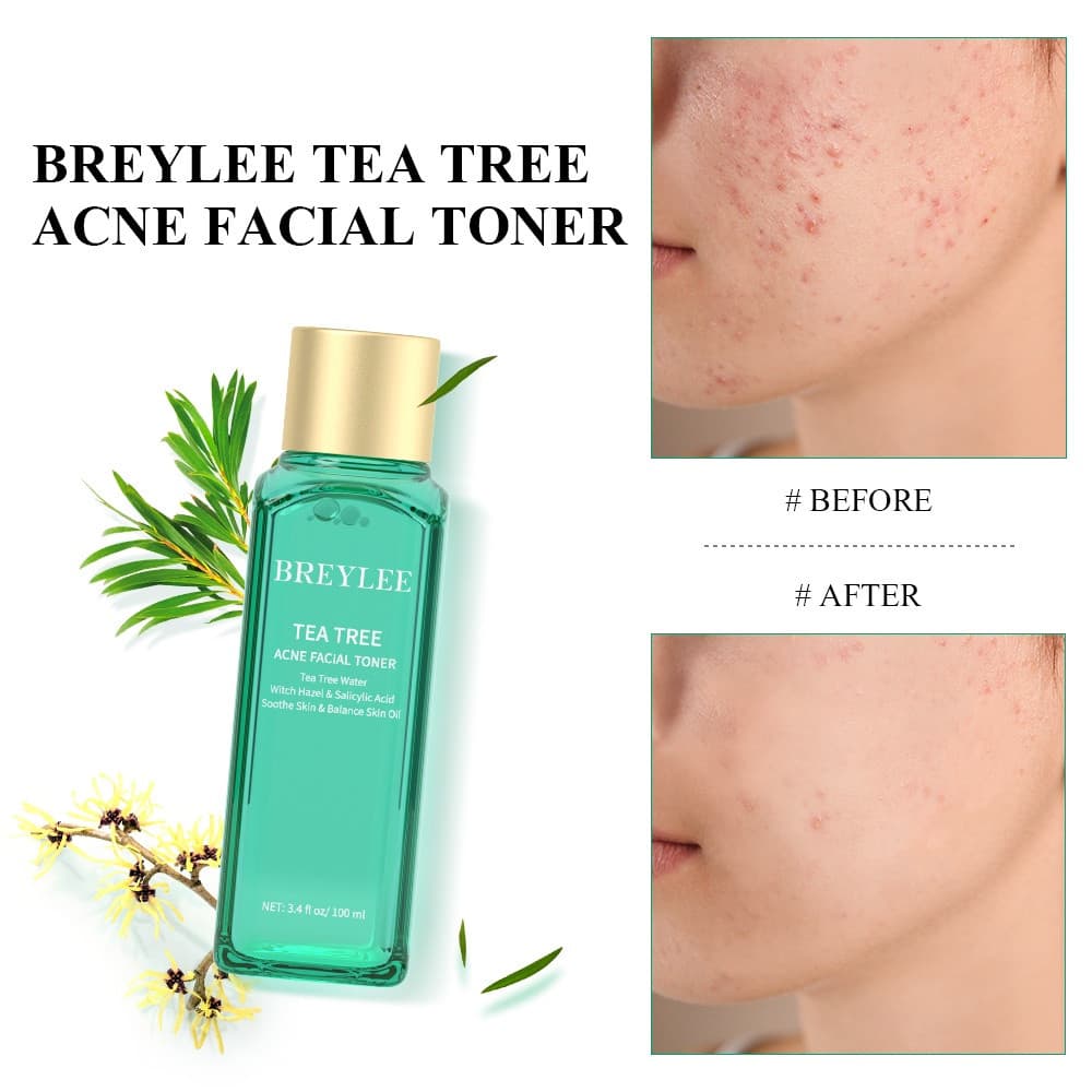 Tônico para Tratamento de Acne com Óleo de Tea Tree BREYLEE, Hidratação Profunda da Pele, Reparação Profunda da Pele, Cu