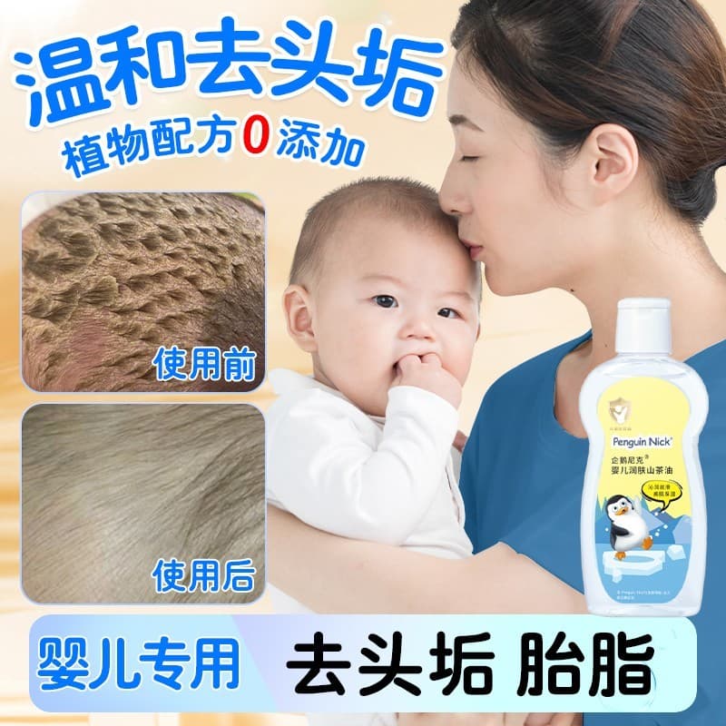 Óleo do bebê remover cravo crosta recém-nascido suavizar couro cabeludo ferramenta útil óleo de sujeira gordura do bebê