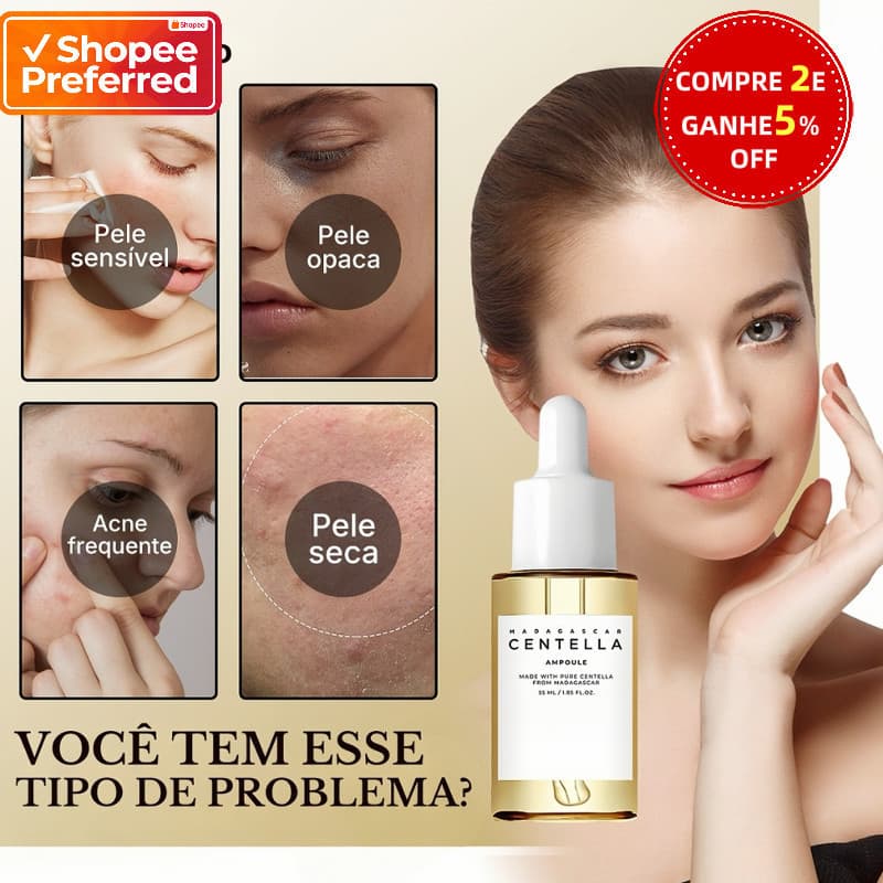 Essência Facial Centella Asiatica Reduz Melanina Hidratante Iluminadora