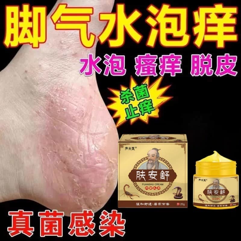 Pé de atleta Anti-coceira Peeling esterilização Bad atleta atleta atleta atleta atleta atleta atleta atleta atleta atlet