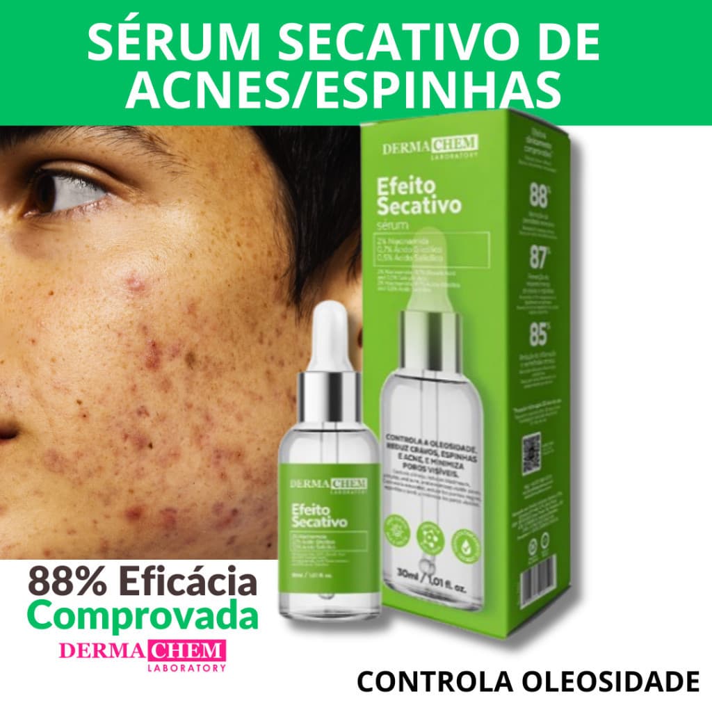 Sérum Facial Efeito Secativo Controle de Acne, Oleosidade, Cravos e Espinhas 30ml | Dermachem