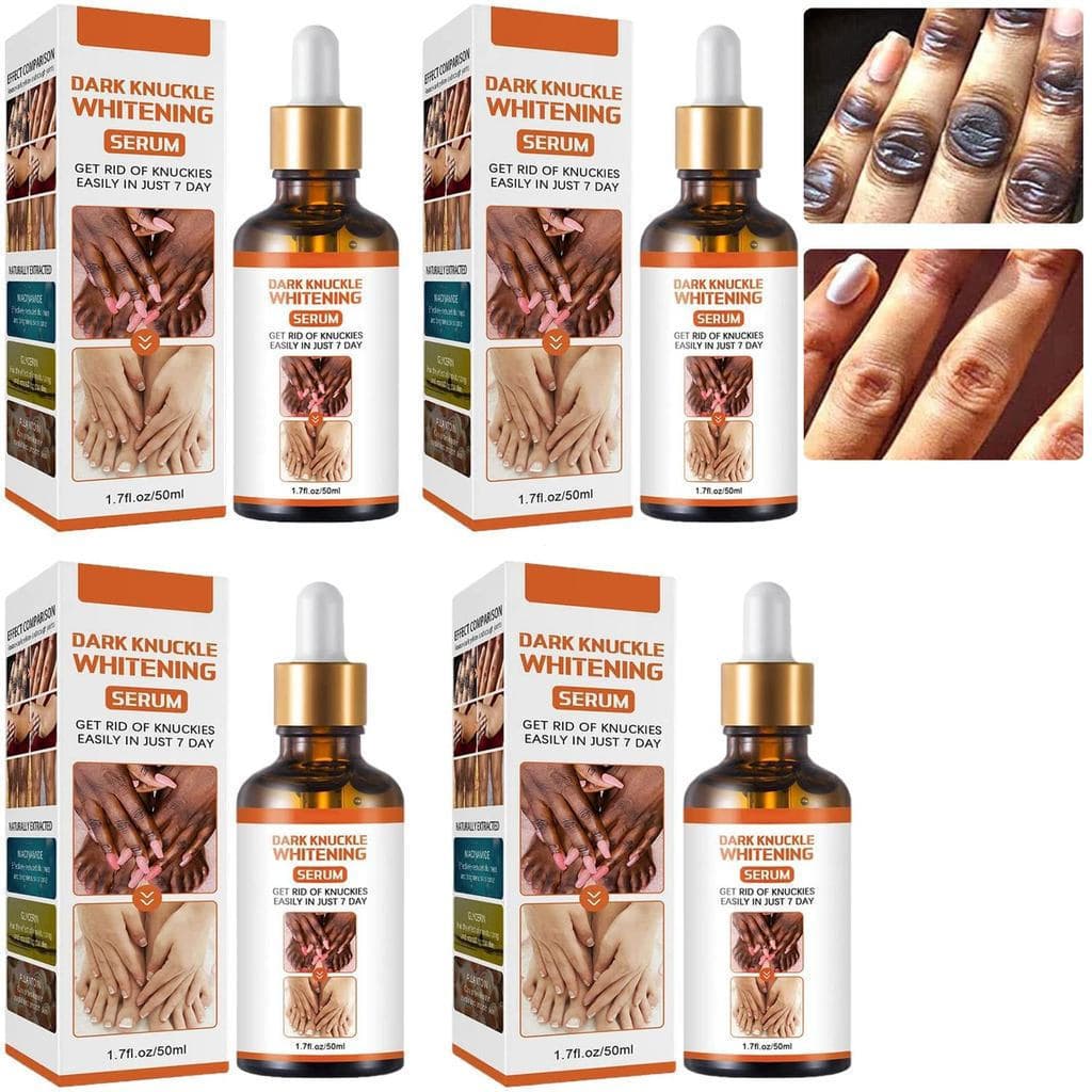 Óleo Corretor de Manchas Escuras Acanthosis Nigricans, Clareador de Manchas Escuras Corporal, Sérum Iluminador, para Ded