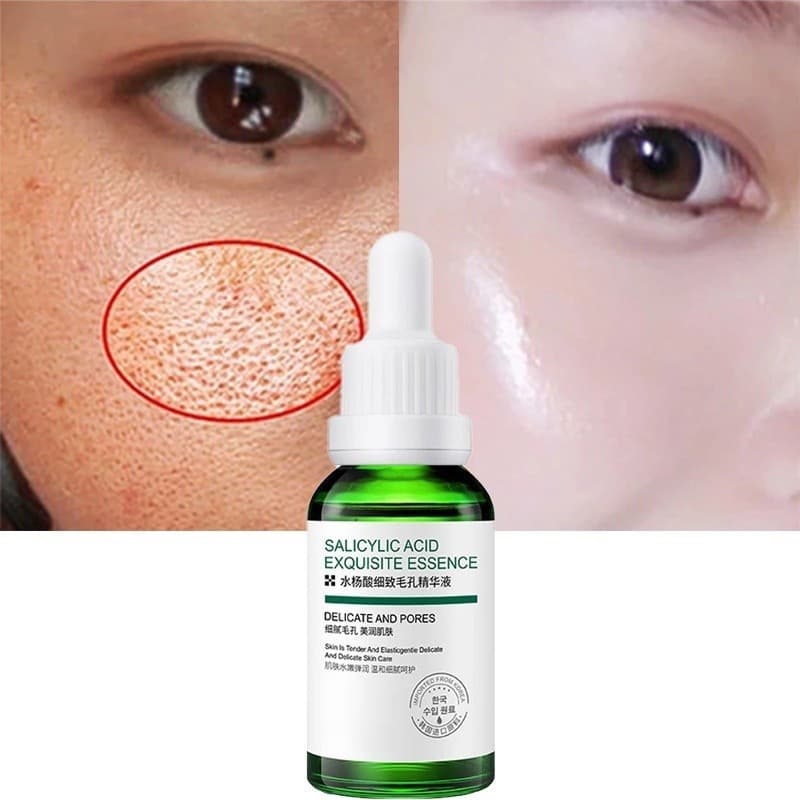 Essência de ácido salicílico com ácido de frutas, encolher poros, remover boca fechada, remover Acne, hidratante, essênc
