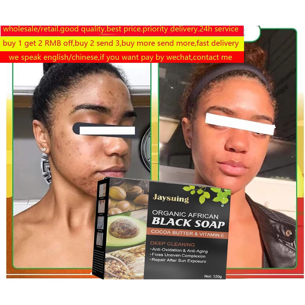 Sabonete Preto Natural Para Pele Africana , Tratamento acne , Carvão À Base De Ervas