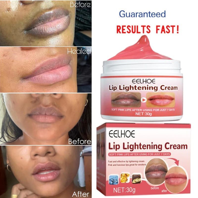 Lábios Pink Fresh Lightening Cream Treatment Remove Dark Moisturizing Hidratante Canto Da Boca