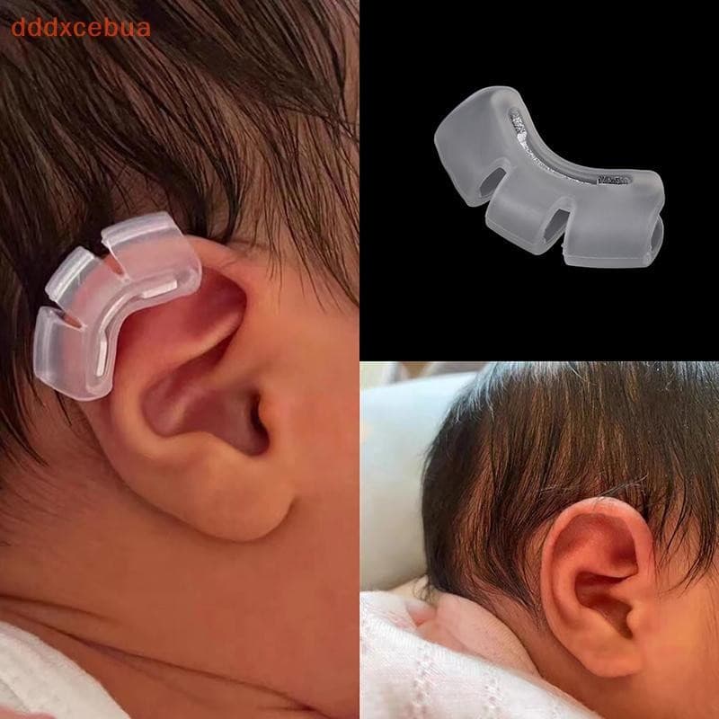 [dddxcebua] 1 Peça Suporte Para Aurícula Bebê Corretor Externo De Saliente De Orelha Almofadas De Ouvido Corretoras Exte
